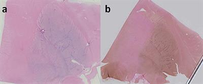 Matching ex vivo MRI With Iron Histology: Pearls and Pitfalls